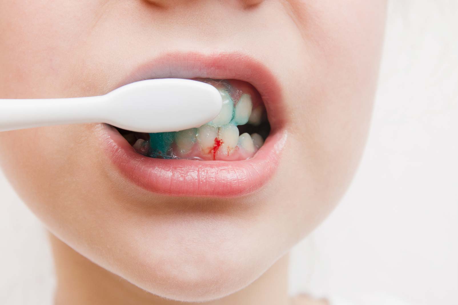 Specialist periodontics - section 2 | Church View Dental Upminster