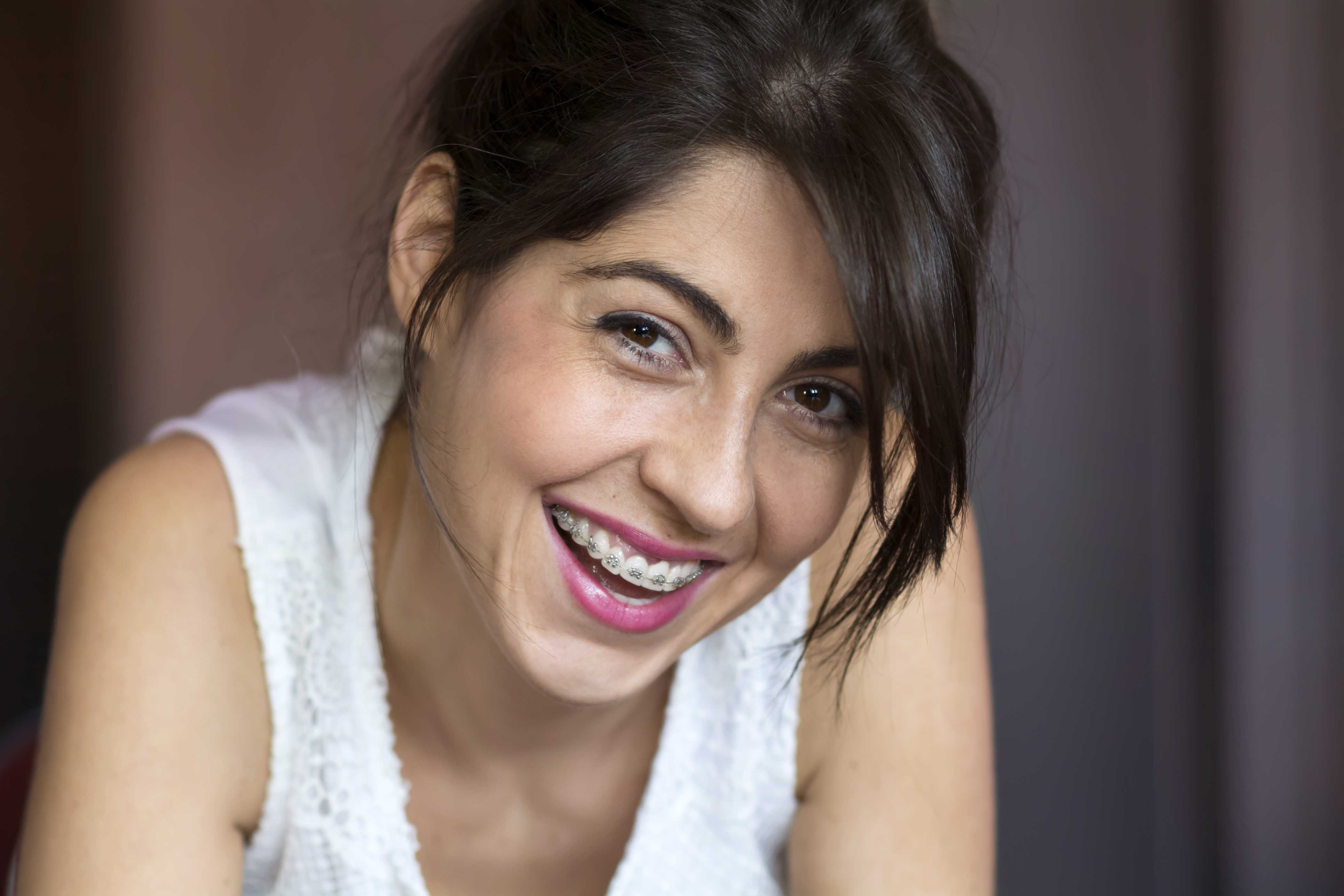 Fixed braces - section 4 | Church View Dental Upminster