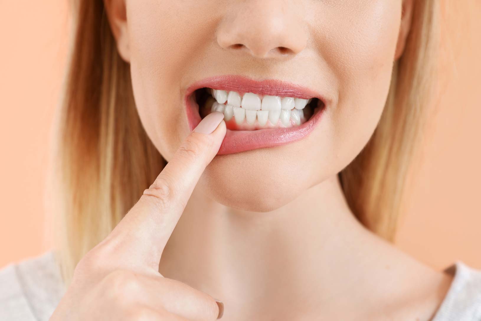 Gum disease - section 2 | Church View Dental Upminster