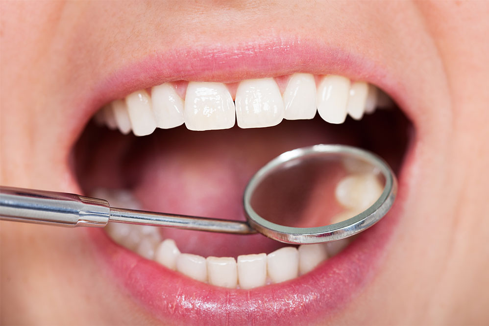 Dental check-ups - section 2 | Church View Dental Upminster