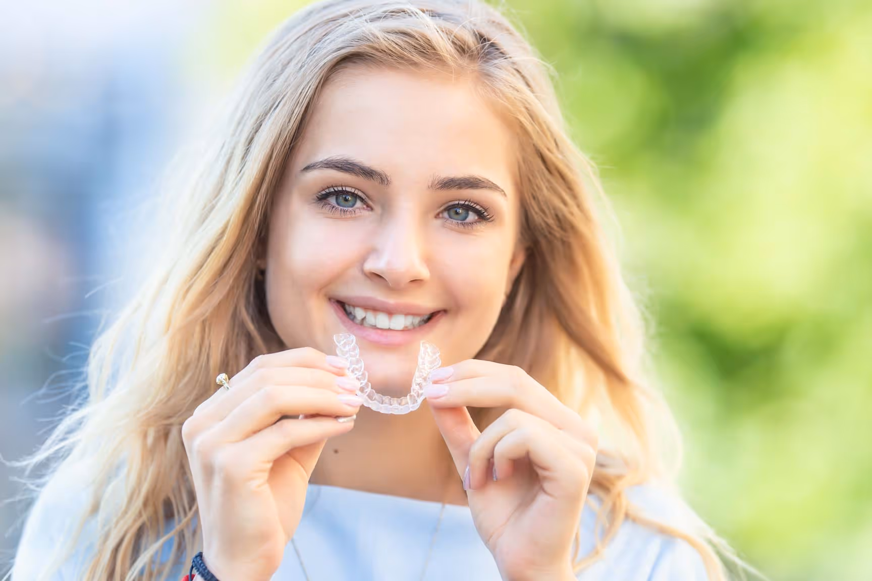 Composite bonding smile transformation at Church View Dental