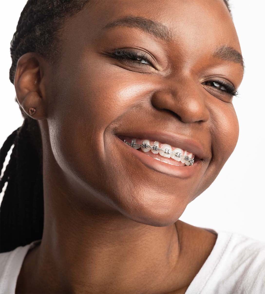 Our orthodontic treatment options at Church View Dental